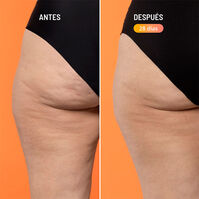 Beta-Burner Sculpting Treatment  100ml-223374 Beta-Burner Sculpting Treatment  100ml-223374 1